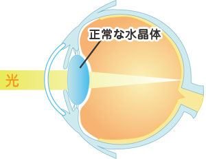 通常